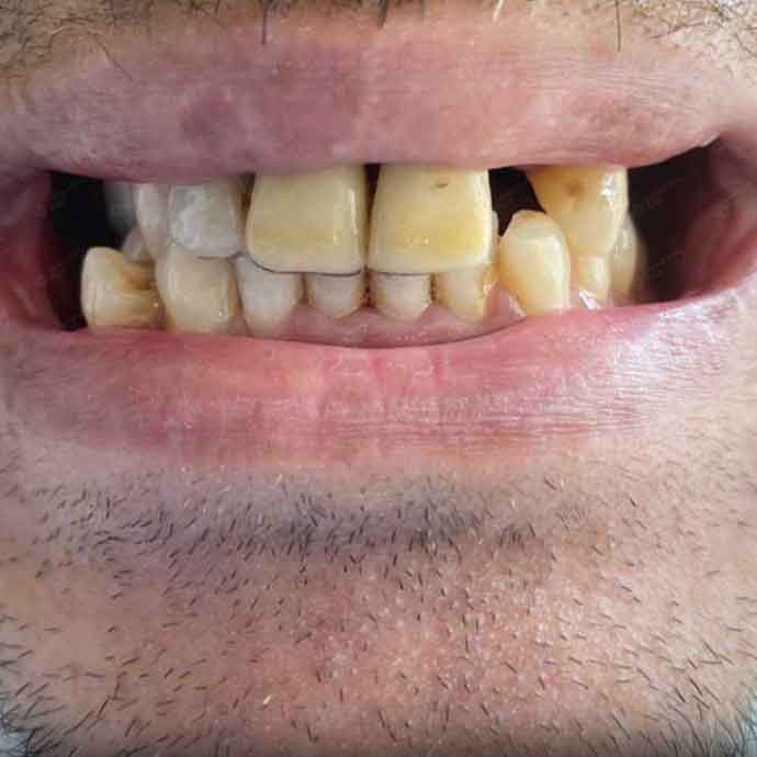 dental-oncesi-2